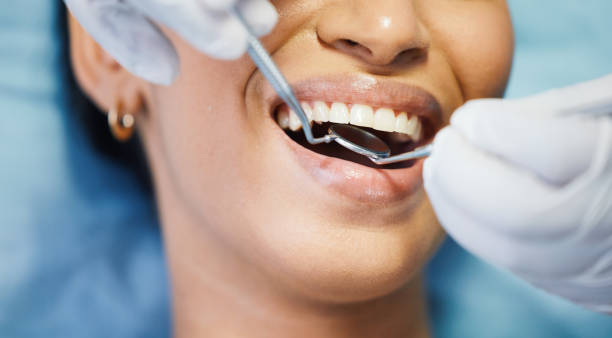 Best Knocked-Out Tooth Emergency  in Bull Run Mountain Estates, VA