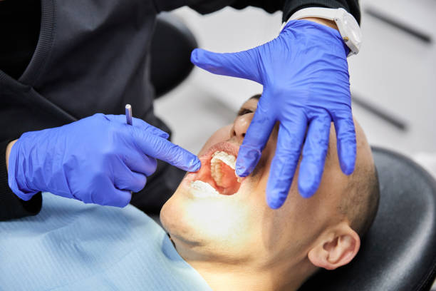 Best Root Canal Emergency Dentist  in Bull Run Mountain Estates, VA